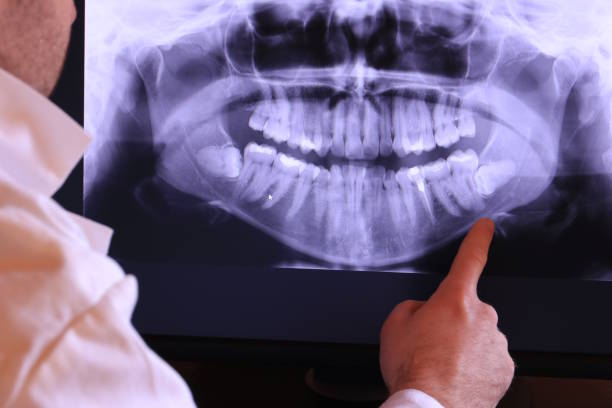 Best Same-Day Emergency Dentist in Cumberland Center, ME